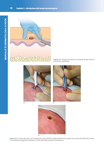Manuale Di Dermatologia Di Rook - 2