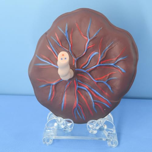 Modèle anatomique de placenta et de cordon ombilical réaliste
