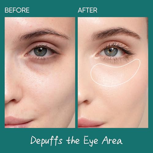 AOPEIBOTO Salmon DNA PDRN Eye Cream for Puffiness and Bags Under Eyes - with Caffeine & Hyaluronic Acid, Niacinamide for Dark Circle & Hydration — view 2