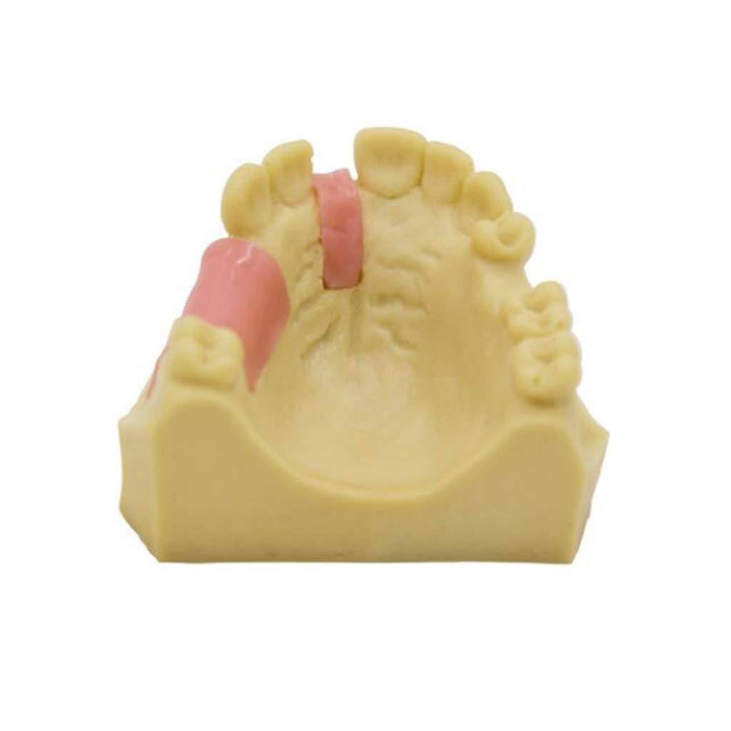 Zęby Model Denture Repair Sadzenie Szkolenia Żywicy Materiał Medyczny Pomoc Szkoleniowa Medyczna