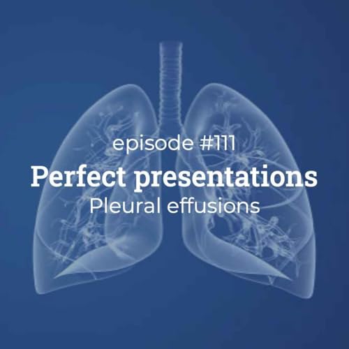 #111 Perfect Presentations: Pleural effusion Podcast Por  arte de portada