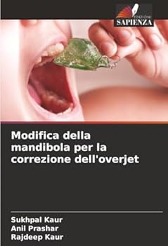 Paperback Modifica della mandibola per la correzione dell'overjet [Italian] Book
