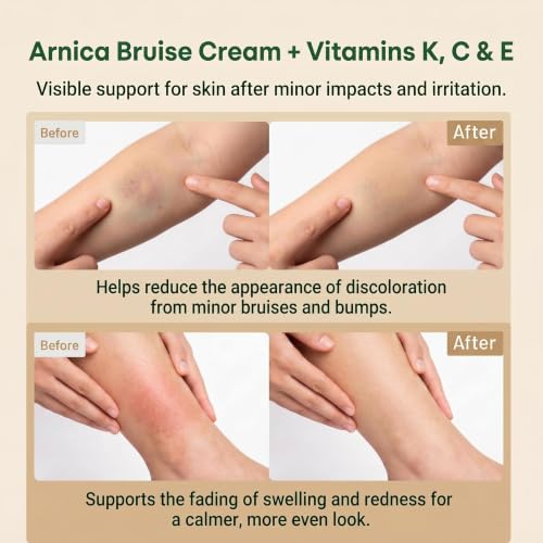 Image of Arnica Bruise Cream Extra Strength for Seniors & Thin Skin, 4.23OZ | Enriched Arnica Montana with Vitamins K, C E for Relief Bruises, Swelling & Discoloration, Daily Care for Bruises Face & Body