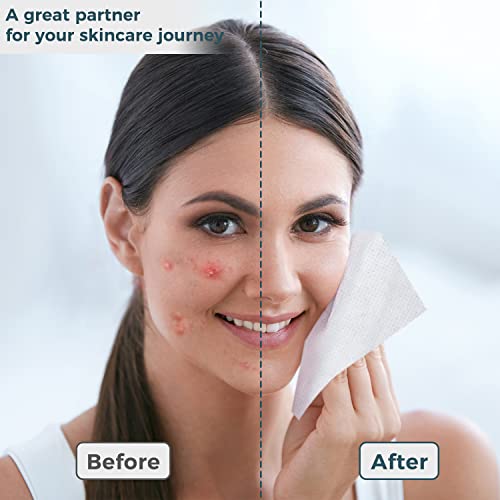 Ourmed Life Disposable Face Towel thumb #6