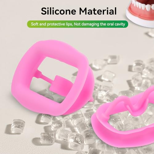 2 Stück Dental-Mundöffner, wiederverwendbar, autoklavierbar, Silikon, Zahnaufhellung, Wangenhalter, Lippenhalter für Zahnarzt, Mundinspektion, Mundschutz, Challenge-Spiel (Rosa)