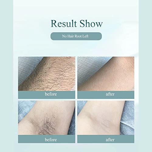 GUOYIHUA Laser DO IPL da Remoção Do Cabelo para As Mulheres e Homens, atualizado para 900,000 Pisca