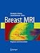 Breast MRI: Diagnosis and Intervention