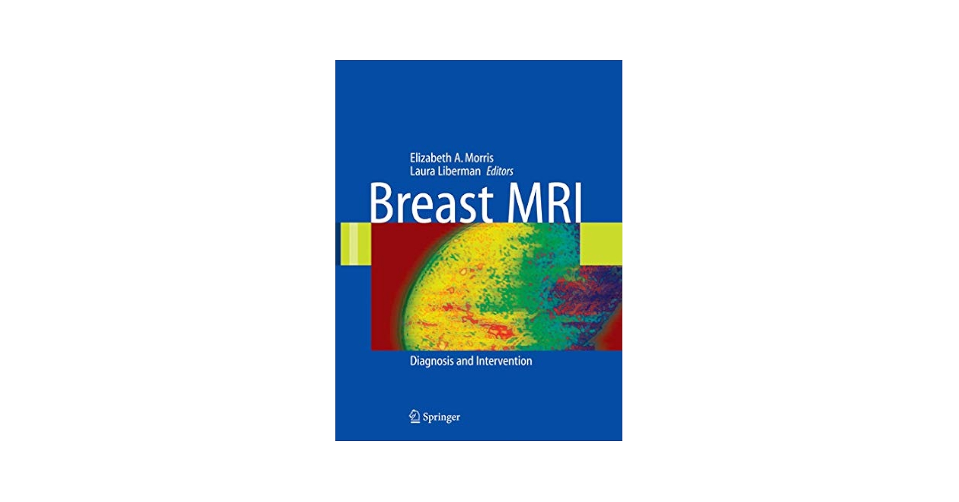 Diagnostic Breast Imaging 第2版 Diagnostic Breast Imaging 第2版 Diagnostic Breast Imaging 第