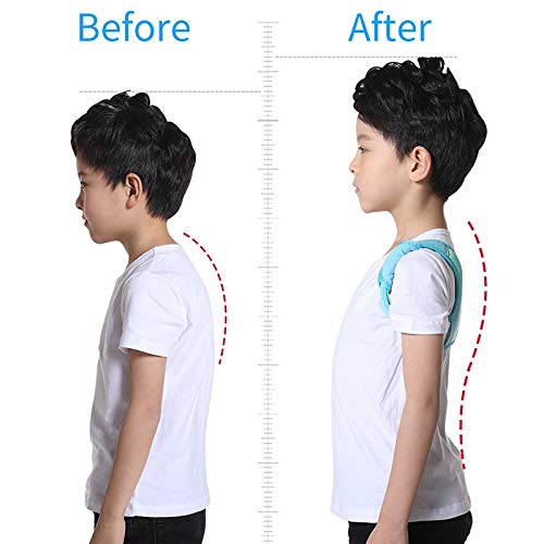 Corrector de Postura Ajustable para niños， cinturón de Soporte de Espalda， corsé ortopédico para niños， Tirantes para la Columna Vertebral， Espalda， lumbares y，Blue-M