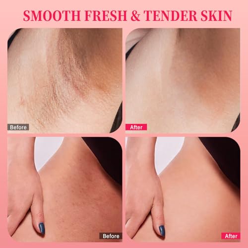 Bikini Area Exfoliator with 10% AHAs BHA & Vitamin C, Exfoliating Body Scrub for Ingrown Hair and Underarm Bumps, Dark Spots, Moisturize Brighten Soothe & Even Skin Tone, Sensitive Skin Safe, 7.76 oz