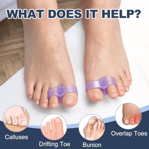 Image of Promifun Gel Toe Corrector, 10 Pack of Toe Separators with 2 Loops, Big Toe Spacer for Bunion Pain and Overlapping Toe - Lavender
