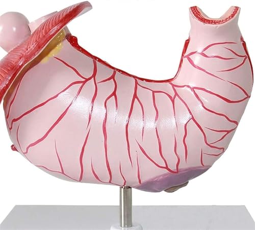 Modèles médicaux d'ulcère gastrique pour simplifier les diagnostics - 7