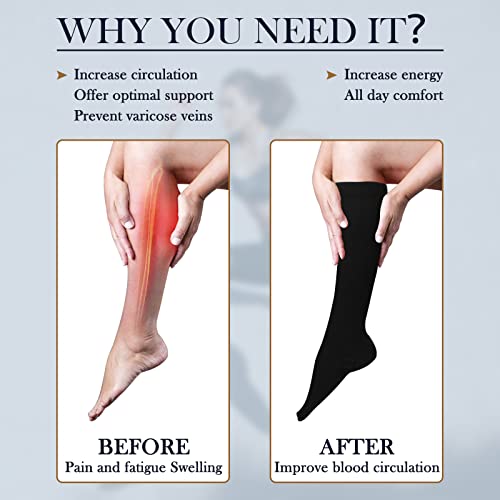 Yogingo 4 Pairs Compression Socks For Women & Men, Circulation 15-20 Mmhg - Knee High Copper Compression Socks For Running, Cycling, Medical, Athletic Nurse, Best Support For Pain Relief (L/Xl) #TOP1