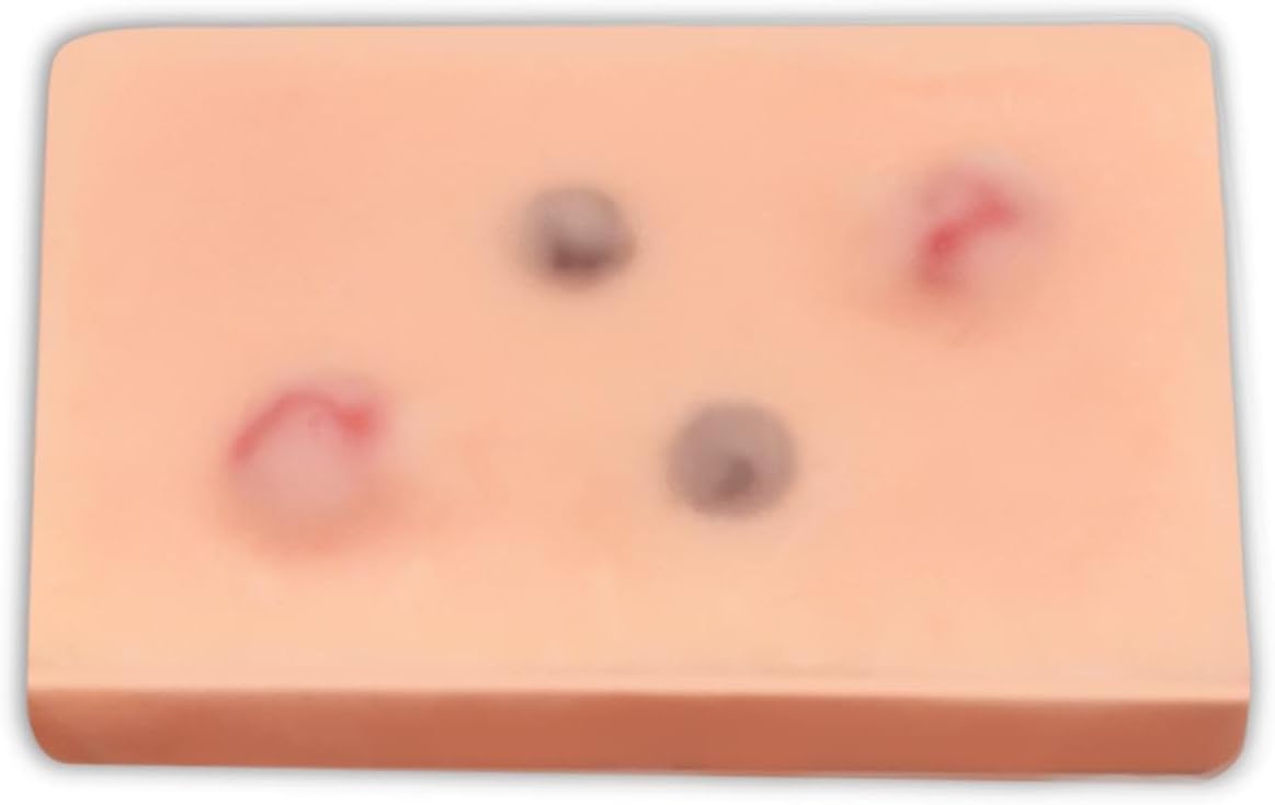 Skin Cyst Excision Training Model - Realistic Skin Lesion Model for Surgical Practice, Dermatology Training, and Cyst Removal Simulation.