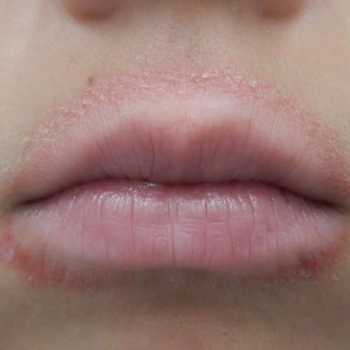 Ep 78: Medical Mysteries: Funky Lip Rash!