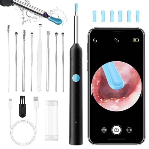 QILUCKY Ear Wax Removal Kit, Wireless Ear Cleaner with Camera 1920P HD, WiFi Otoscope with 6 LED Lights & 8 Ear Spoons, Earwax Remover Tool for Camera for iPhone Android Phones (Black)