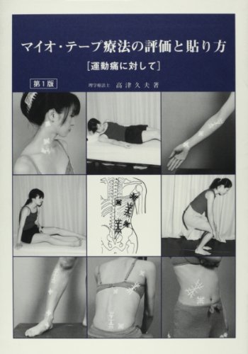 マイオ・テープ療法の評価と貼り方[運動痛に対して]