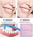 2Pcs Acssart Radiant Whitening Toothpaste,Niacinamide Whitening Toothpastes, Fresh Breath Stain Removal