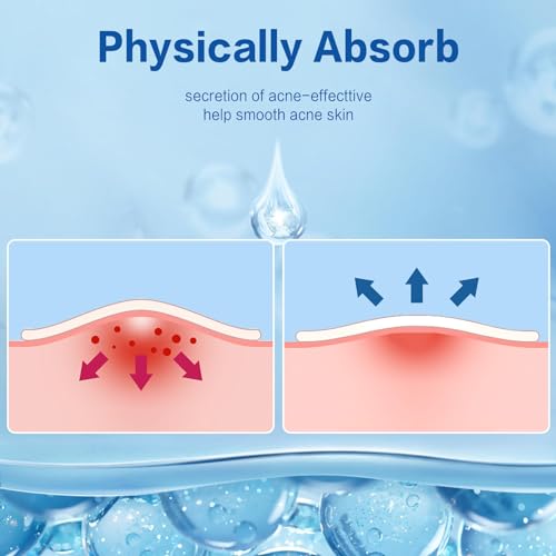 450 Pimple Patches for Face, Hydrocolloid Acne Patches for Zit Covers, Invisible Skin Stickers for Blemish Spot Treatment, 4 Sizes, with Salicylic Acid, Tea Tree & Coconut Oil