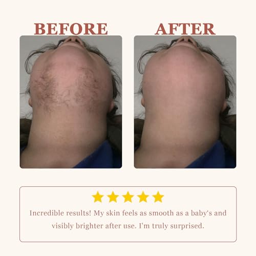 Facial Hair Removal Cream for Women Sensitive Skin - Painless Depilatory Cream for Face Upper Lip Chin & Cheeks with Spatula, 5-Minute At-Home Hair Remover for Pubic, 1.68 Fl Oz