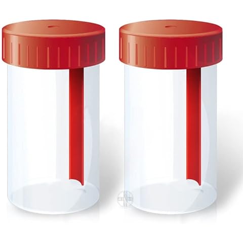 Saraoriginalshop 2 recipientes estériles para heces con pala tapa hermética y etiqueta de datos adhesiva 60 ml Cover