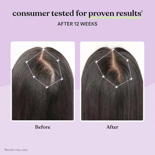 Lemme Grow Hair Growth Capsules