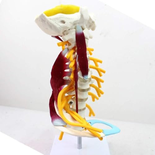 Modèle d'araignée cervicale AMITD dans votre cabinet pour expliquer l'anatomie