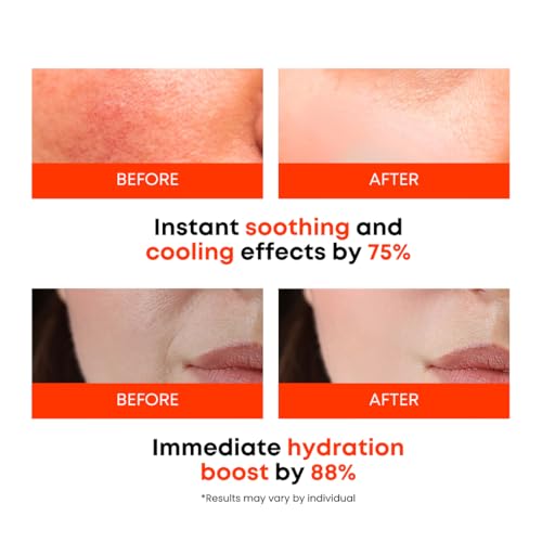 Image of Carrot Calming Toner Pads - Korean Toner Pads with Centella Asiatica, Redness Reducing Skin Care, Pore Minimizer, Soothing & Hydrating with Jeju Carrot Extract, 100% 7 Layer Cotton 40 Pad