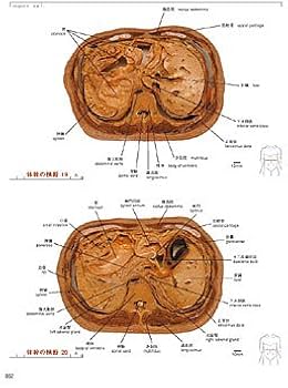 419XV0F6QCL._AC_UF350,