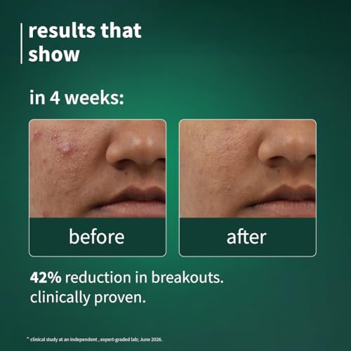 Image of Plum SebaClearTM Mattifying Gel Creme with Matcha & Sebacic Acid | 50g