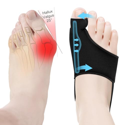 2PCS Bunion Corrector for Women & Men Big Toe Straightener-Bunions Correction Women & Men-Bunion Splint-Bunions Pads for Bunion Relief-Hallux Valgus Pain Relief,Comfortable & Breathable for Day/Night
