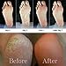 Award-Winning Foot Peeling Mask - Dr. Pedicure Foot Peel Masks (4 Pairs, Coconut) - Moisturizing Foot Masks That Remove Dead Skin, Exfoliating Foot Mask for Dry Cracked Feet, Feet Peeling Mask