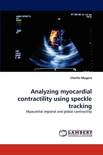 Analyzing myocardial contractility using speckle tracking: Myocardial regional and global contractility