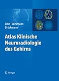 wiesmann roadster preis  Atlas Klinische Neuroradiologie des Gehirns