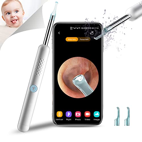 Ear Wax Removal Tool, Wireless Endscope Camera Wax Removal Kit 1080P Fhd Wifi Ear Cleaner With 6 Led Lights, Ear Pick Kit For Adults Kids & Pets #TOP1