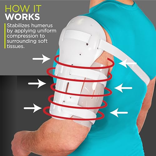 BraceAbility Sarmiento Brace - Humeral Shaft Fracture Splint Cast for Broken Upper Arm, Shoulder, Bicep and Humerus Bone with Stockinette, Sling and Cuff Support (Medium)