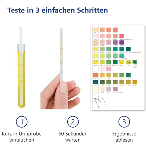 100x LuxmedIQ Urin Teststreifen - 10 Parameter Harnteststreifen - Teste auf Harnwegsinfektionen, Blasenentzündungen, Säure-Base Haushalt, Ketose, Diabetes, Leber- & Nierenerkrankungen, Blut im Urin