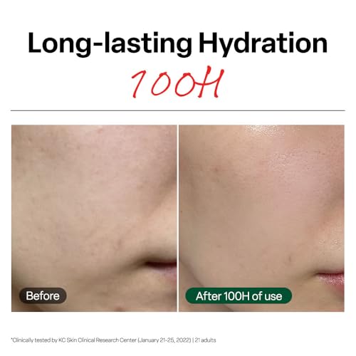 Dr.G Dr. G R.E.D. Blemish Clear Soothing Cream - Calming Korean Moisturizer for Redness - Soothes Acne & Irritation - With Centella Asiatica - Long-Lasting Hydration - 2.36 fl oz