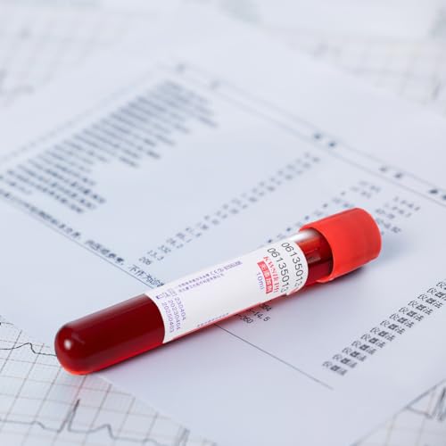 iplusmile 100pcs 10ml Glass Blood Collection Tubes Vacuum Blood Tubes with Screw Cap Negative Pressure Tub Glass Centrifuge Tubes Laboratory Tubes, Red, 10x1.5cm