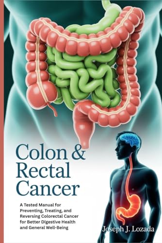 COLON & RECTAL CANCER: A Tested Manual for Preventing, Treating,...