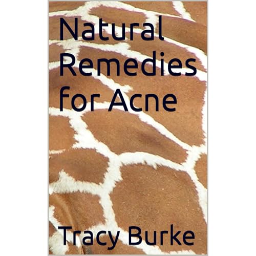 Natural Remedies for Acne Audiolibro Por Tracy Burke arte de portada