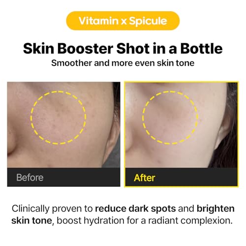 Cell Fusion C Viral Dark Spot Care Duo — Vita Shot Ampoule + Laser UV Defense Sunscreen SPF 50 Set | Dark Spot Correcting + Sun Protection | Sensitive Skin Safe, Korean Skincare Set