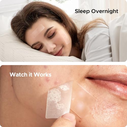 TKTK Adesivos grandes de espinhas, adesivos de acne GG de 60 mm, bandagens hidrocolóides grandes par