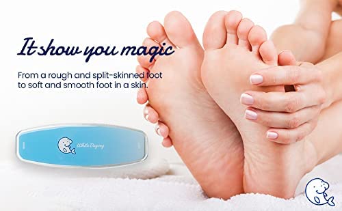 Glass-Foot-File--Hard-Dead-Corn-Skin-Callus-Remover-Nano-Scrubber-Rasp-Feet-Care-Pedicure-Remove-Cracked-Heels-Professional-Tool-Made-in-Korea-Mint