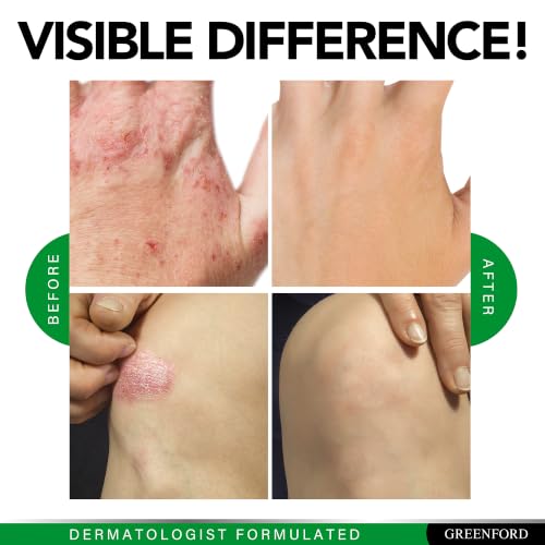 Image of Skin Health Supplement - Clear-Looking Skin from Within - 60 Caps (2 Pack)