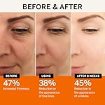 Vitamin C Face Serum: Anti Aging Facial Super Vit C Serum with Ferulic Acid Pure L-Ascorbic Acid, Vitamin E and Hyaluronic Acid for Dark Spots and Skin Care - Image 4