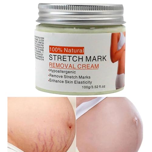 Belly Mark Cream,Crema Para Marcas Del Embarazo 100g Mujeres Embarazadas - Solución De Hidratación Para Sequedad Para Amigas, Esposa, Hermanas Y