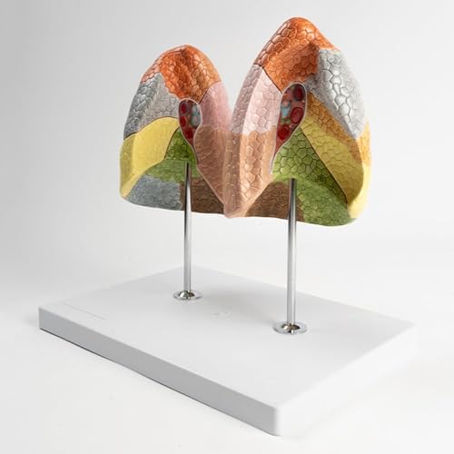 Modèle de poumon coloré à 10 segments pour anatomie médicale AMITD - 2