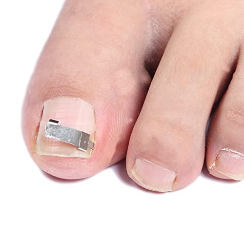 LIANGYAN Kit de ferramentas de unha encravada Corretor de pedicure de unhas Remoção de unha encravad