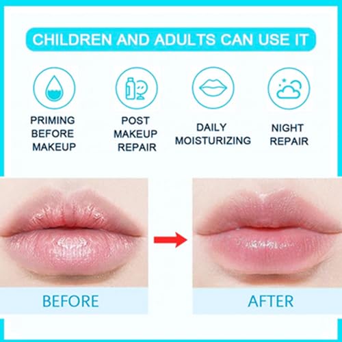 Moisturizing Lip Balm Set, 8lip Balm Sets, Lip Balm Set, For Day And Night Lip Care, Repair Dry And Peeling Lips-Reduce lip Lines And Wrinkles - Image 5